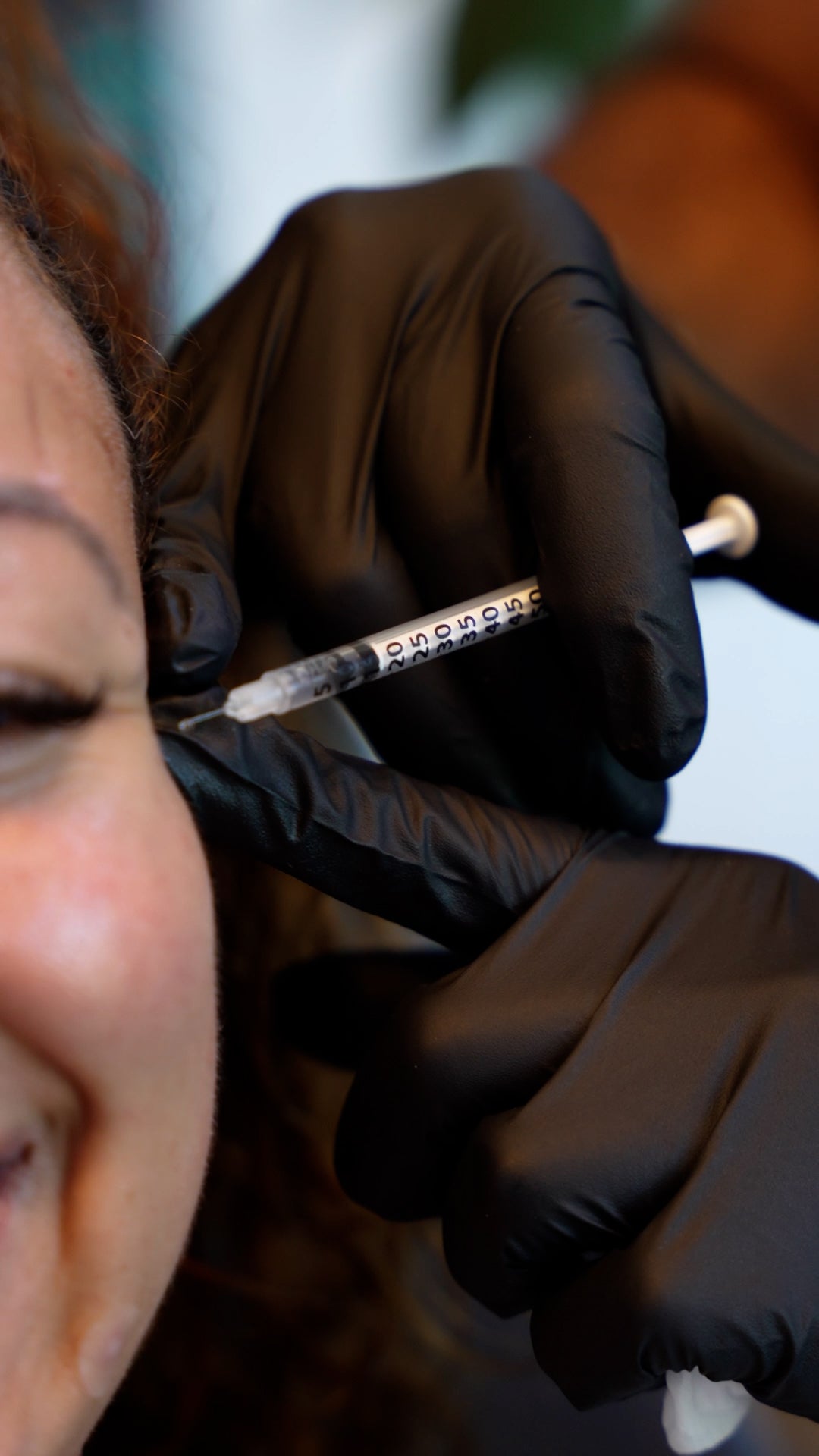 Tox Anti- Wrinkle 60 units