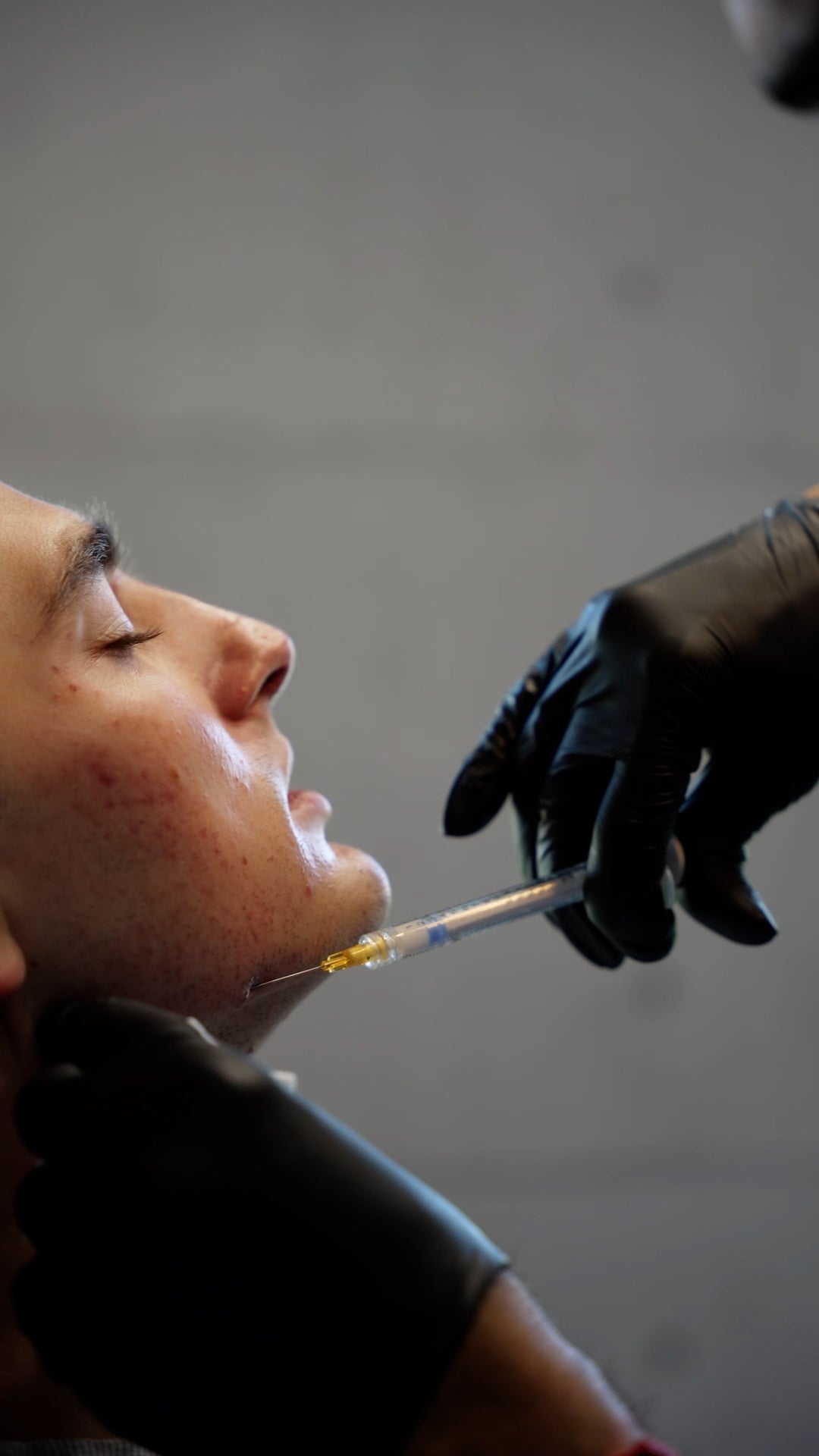 Mens Jawline Contouring