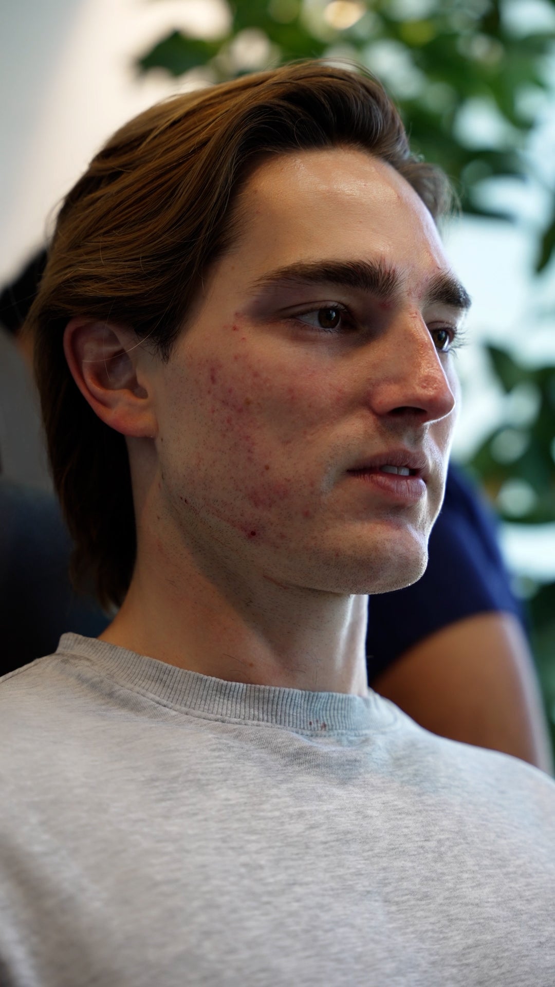 Mens Jawline Contouring